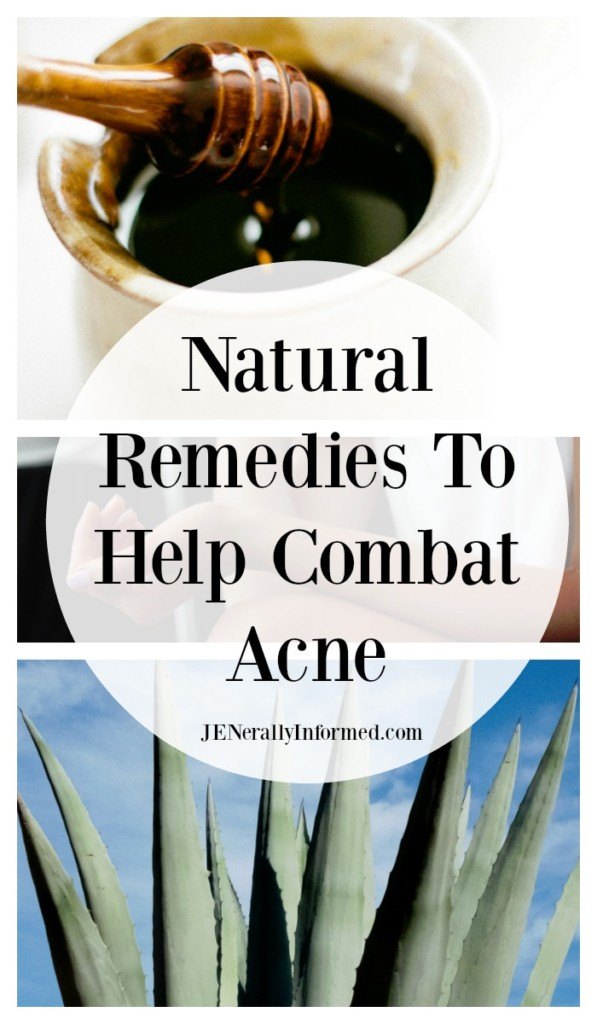 Natural Remedies To Help Combat Acne. Including DIY face masks, essential oils you should know about and tons more great info!